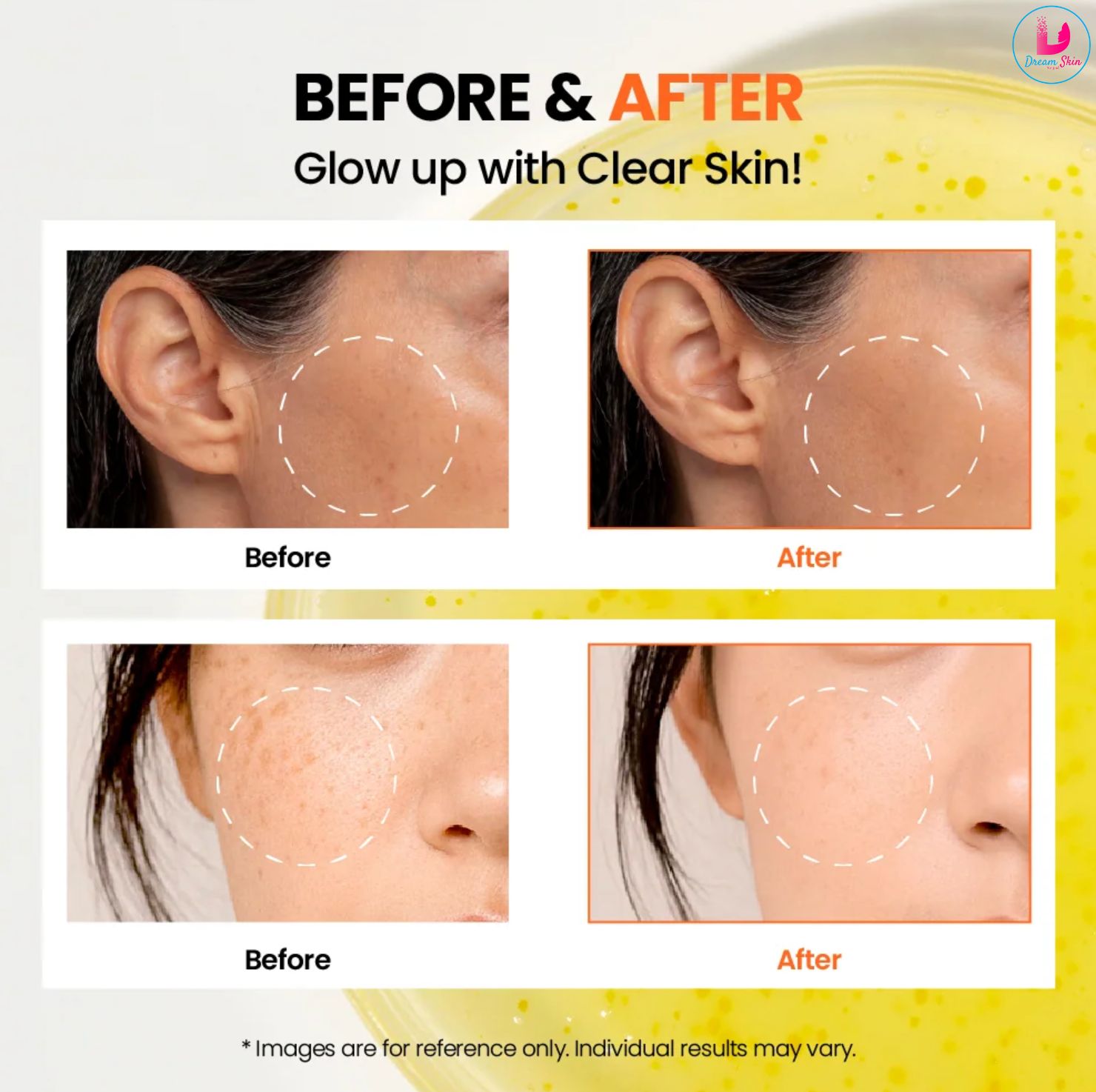 KSECRET SEOUL 1988 Glow Serum Niacinamide 15% + Yuja [30ml]